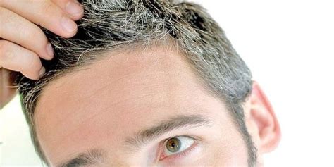 dermatoloji saç beyazlaması